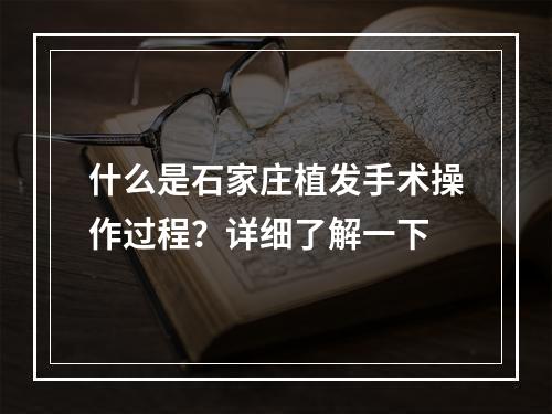 什么是石家庄植发手术操作过程？详细了解一下