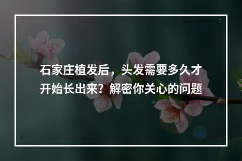 石家庄植发后，头发需要多久才开始长出来？解密你关心的问题