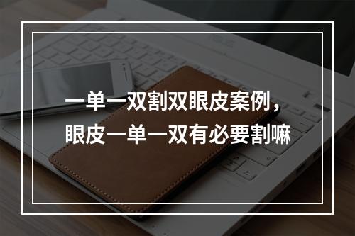 一单一双割双眼皮案例，眼皮一单一双有必要割嘛