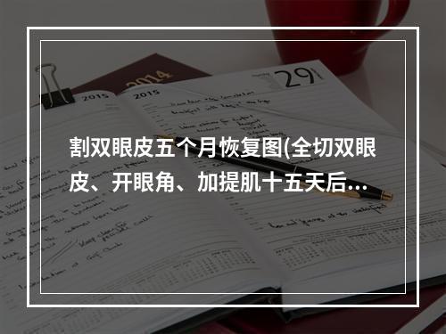 割双眼皮五个月恢复图(全切双眼皮、开眼角、加提肌十五天后会恢复成什么样子)