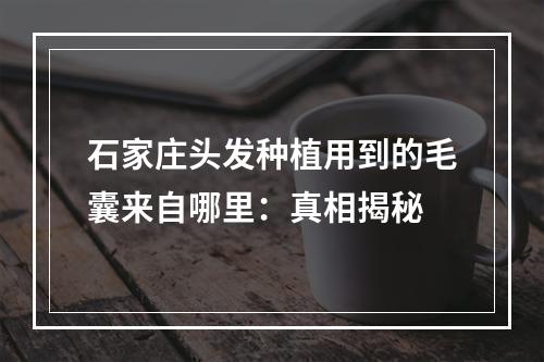 石家庄头发种植用到的毛囊来自哪里：真相揭秘