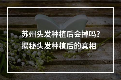 苏州头发种植后会掉吗？揭秘头发种植后的真相