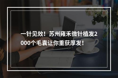 一针见效！苏州雍禾微针植发2000个毛囊让你重获厚发！