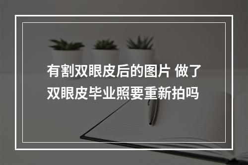 有割双眼皮后的图片 做了双眼皮毕业照要重新拍吗