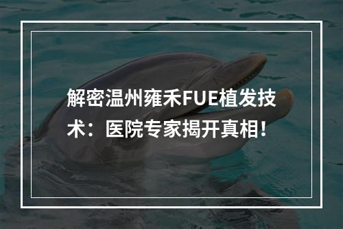 解密温州雍禾FUE植发技术：医院专家揭开真相！