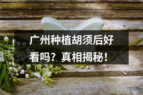 广州种植胡须后好看吗？真相揭秘！