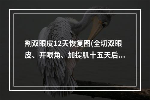 割双眼皮12天恢复图(全切双眼皮、开眼角、加提肌十五天后会恢复成什么样子)