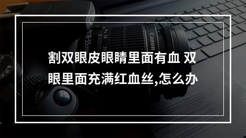 割双眼皮眼睛里面有血 双眼里面充满红血丝,怎么办