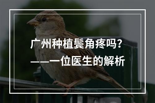 广州种植鬓角疼吗？——一位医生的解析