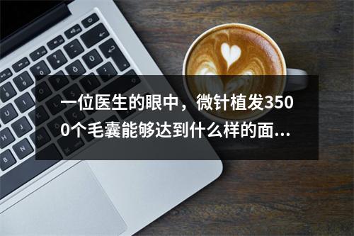 一位医生的眼中，微针植发3500个毛囊能够达到什么样的面积？