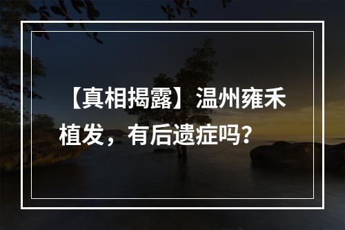 【真相揭露】温州雍禾植发，有后遗症吗？