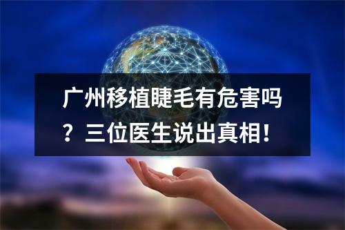 广州移植睫毛有危害吗？三位医生说出真相！