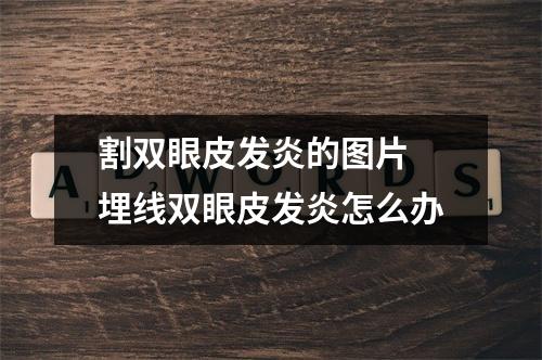 割双眼皮发炎的图片 埋线双眼皮发炎怎么办