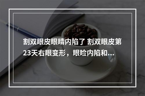 割双眼皮眼睛内陷了 割双眼皮第23天右眼变形，眼睑内陷和下垂，是不是失败了