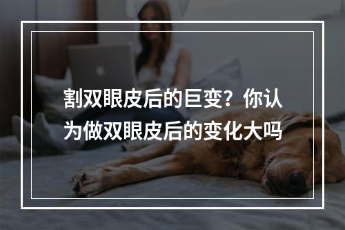 割双眼皮后的巨变？你认为做双眼皮后的变化大吗