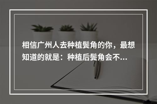 相信广州人去种植鬓角的你，最想知道的就是：种植后鬓角会不会掉呢？