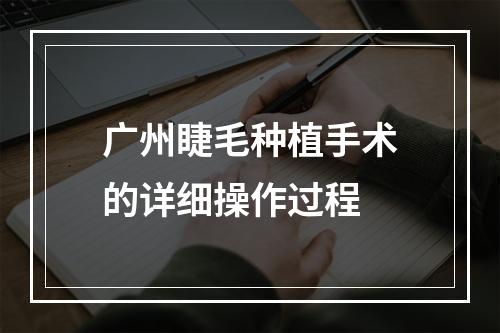 广州睫毛种植手术的详细操作过程