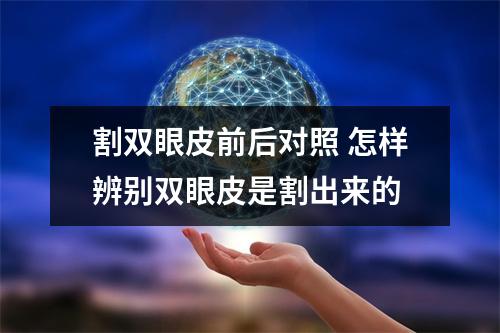 割双眼皮前后对照 怎样辨别双眼皮是割出来的