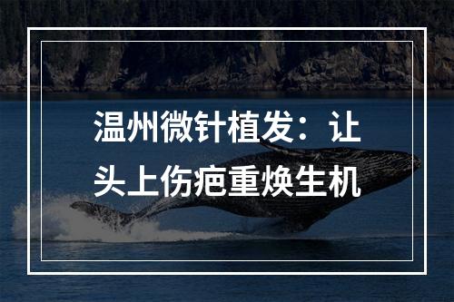 温州微针植发：让头上伤疤重焕生机