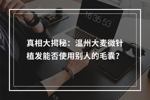 真相大揭秘：温州大麦微针植发能否使用别人的毛囊？