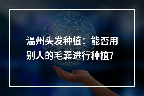 温州头发种植：能否用别人的毛囊进行种植？