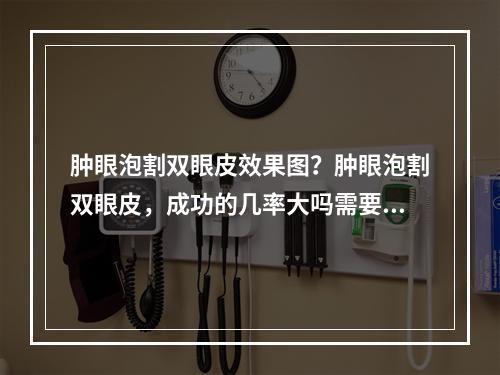 肿眼泡割双眼皮效果图？肿眼泡割双眼皮，成功的几率大吗需要注意什么