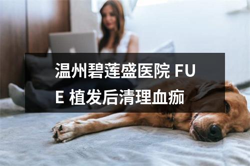 温州碧莲盛医院 FUE 植发后清理血痂