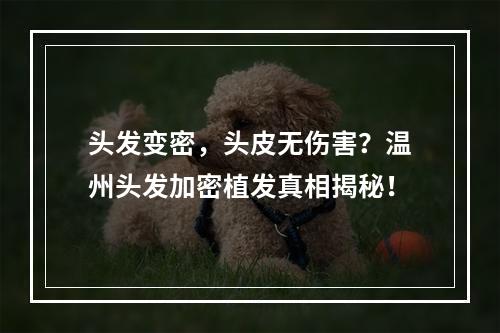 头发变密，头皮无伤害？温州头发加密植发真相揭秘！