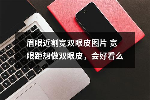 眉眼近割宽双眼皮图片 宽眼距想做双眼皮，会好看么