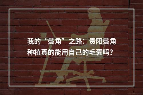 我的“鬓角”之路：贵阳鬓角种植真的能用自己的毛囊吗？