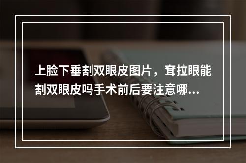 上脸下垂割双眼皮图片，耷拉眼能割双眼皮吗手术前后要注意哪些事项