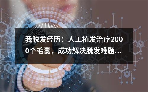 我脱发经历：人工植发治疗2000个毛囊，成功解决脱发难题！