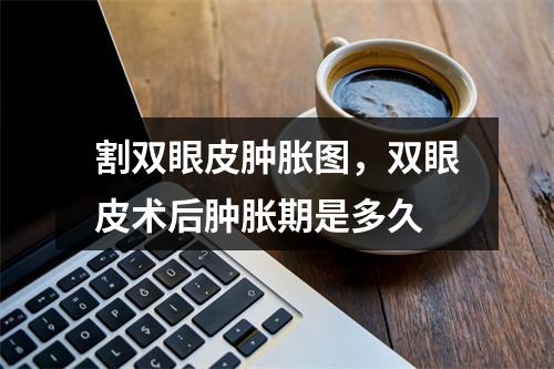 割双眼皮肿胀图，双眼皮术后肿胀期是多久