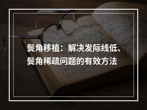 鬓角移植：解决发际线低、鬓角稀疏问题的有效方法