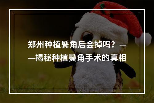 郑州种植鬓角后会掉吗？——揭秘种植鬓角手术的真相