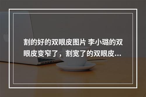 割的好的双眼皮图片 李小璐的双眼皮变窄了，割宽了的双眼皮还能修复吗