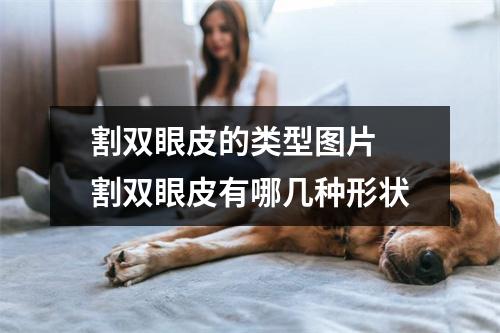 割双眼皮的类型图片 割双眼皮有哪几种形状