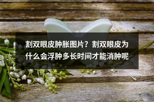 割双眼皮肿胀图片？割双眼皮为什么会浮肿多长时间才能消肿呢