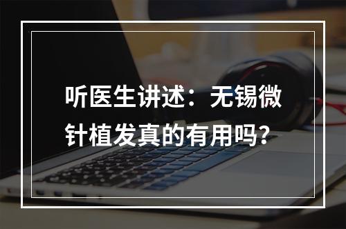 听医生讲述：无锡微针植发真的有用吗？