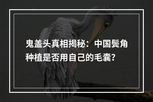 鬼盖头真相揭秘：中国鬓角种植是否用自己的毛囊？