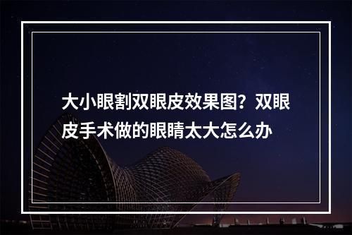 大小眼割双眼皮效果图？双眼皮手术做的眼睛太大怎么办