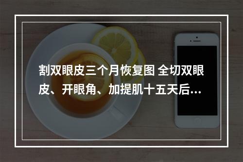 割双眼皮三个月恢复图 全切双眼皮、开眼角、加提肌十五天后会恢复成什么样子