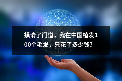 摸清了门道，我在中国植发100个毛发，只花了多少钱？