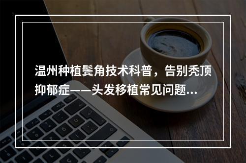 温州种植鬓角技术科普，告别秃顶抑郁症——头发移植常见问题解答