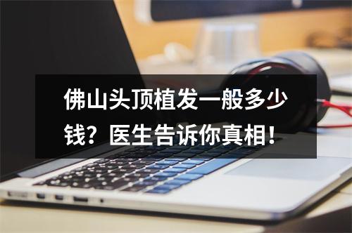 佛山头顶植发一般多少钱？医生告诉你真相！