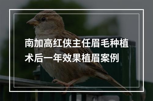 南加高红侠主任眉毛种植术后一年效果植眉案例