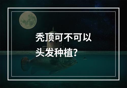 秃顶可不可以头发种植？