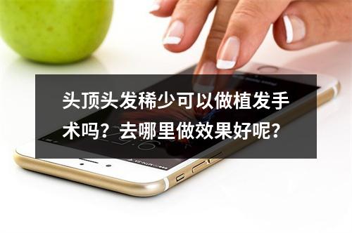 头顶头发稀少可以做植发手术吗？去哪里做效果好呢？