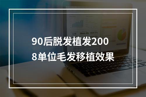 90后脱发植发2008单位毛发移植效果