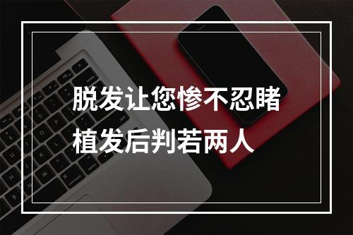 脱发让您惨不忍睹植发后判若两人